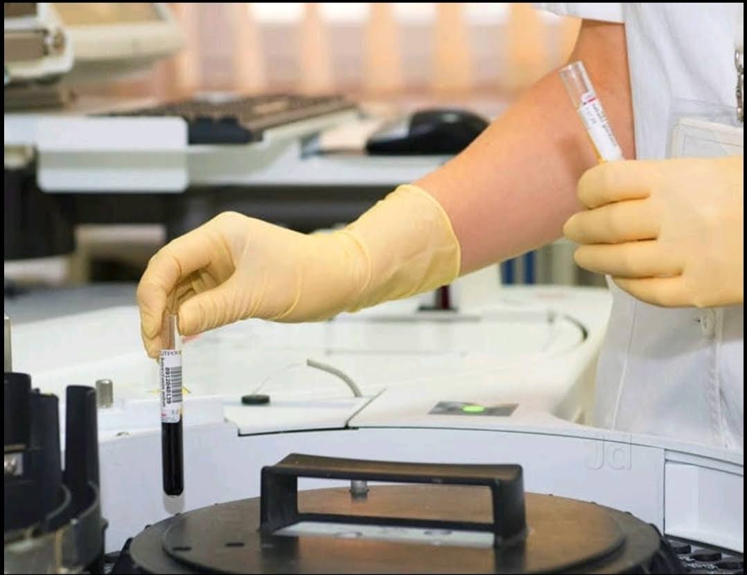 Allergy Test product image