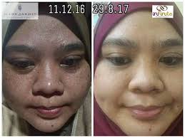 Ubat gigi seperti colgate, darlie, fresh namun, tahukah anda bahawa selain daripada untuk memberus dan mencuci gigi, ubat gigi juga mempunyai banyak lagi kegunaannya seperti menyingkirkan dan menghilangkan jeragat. Hilangkan Jeragat