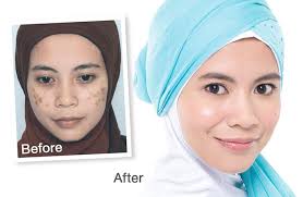 New York Skin Solutions in Singapore
