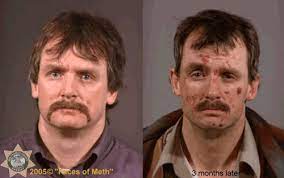 Photos How Methamphetamine Destroys Your Face And Physical Appearance Abc13 Houston