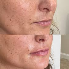 Robin Koval, PA (@robinkoval_pa) • Instagram photos and videos