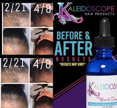 Maybe you would like to learn more about one of these? Kaleidoscope Miracle Drops 2oz Hair Regrowth Treatments Hair Regrowth Vitamins Help Hair Loss