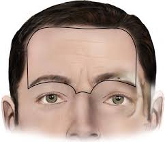 Image result for Forehead Regional Block