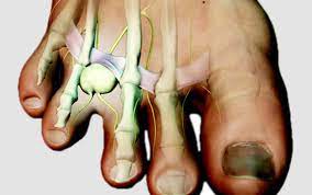 Walking On A Pebble Or A Crumpled Sock