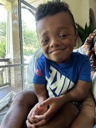 Please teach your kids to be kind to ones that may look like mine❤️‍🩹