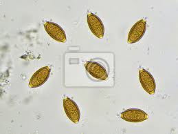 Bandwürmer sind darmparasiten, die wie ein maßband geformt sind. Eier Von Trichuris Trichiura Peitschenwurm Im Stuhl Analysieren Leinwandbilder Bilder Fakal Bandwurm Kot Myloview De