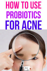 Birth Control Pills That Help With Acne How To Use Probiotics For Acne Free Skin How To Treat Acne Probiotics Hormonal Acne Treatment