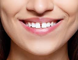Services include extractions, fillings, xrays and cleaning to low income/ non insured clients from throughout out the area. Best Dentist In Guntur Best Dental Clinic Near Me Dhruthi Clinics