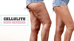 Dec 03, 2018 · it's definitely not a sexy, quick fix, but maintaining a healthy lifestyle in general can be helpful in making cellulite less noticeable. How To Get Rid Of Cellulite Naturally Glamrs Skin Care Youtube