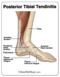 Pin On Heel Pain