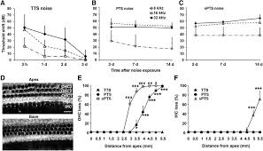 Alat pencernaan makanan di dalam perut : Noise Induces Tts Pts And Spts In Adult Cba J Mice A Tts 96 Db Download Scientific Diagram