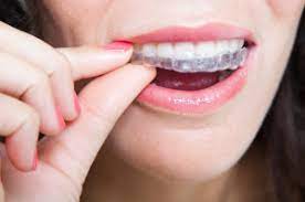 If you have a removable retainer, you may wear it more often at first and then slowly wear it less over time. I Ve Always Worn My Clear Nighttime Retainers Religiously Can I Get My Permanent Metal Retainers Taken Out Medical Sciences Stack Exchange