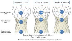 Corevalve Sizing