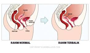 We did not find results for: Gambar Rahim Normal