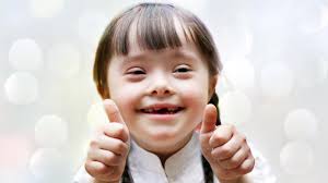 If you have a story that you would like to share with the world you. Alles Zum Thema Down Syndrom Rtl De Rtl De