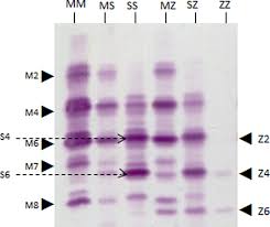 The Role and Importance of Glycosylation of Acute Phase Proteins with Focus 