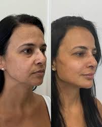 A nova voz que vem conquistando o Brasil chega com um lançamento especial!  🚀 Nesta quinta, 25/09, às 21h, @mariliatavares estreia nas plataformas de  áudio o projeto “Ao Vivo em São José