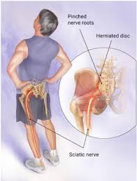 You also have a nerve that runs from your lower spine through your buttocks to the back of your thigh, called the. Are You Having Shooting Pain Down Your Leg Here S What You Should Do About It Betterpt Blog