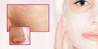 Cara Efektif Mengecilkan Pori Pori Wajah Yang Besar Luvizhea