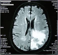 Pin On Mri Scans