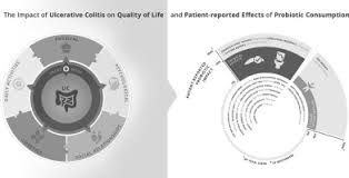 Typical symptoms include diarrhea with overt rectal bleed, abdominal pain. Probiotics For Improving Quality Of Life In Ulcerative Colitis Exploring The Patient Perspective Sciencedirect