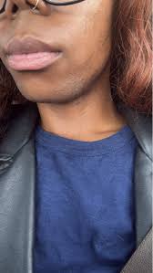 How to reduce facial hair and fatigue with pcos?