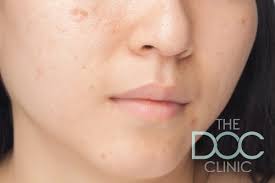 Pigmentation is a condition that leads to darkening or lightening of the skin than its normal color. Skin Pigmentation Conditions Causes And Treatment Options The Doc Cosmetic Skin Clinic