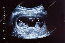 Obstetricia Imagens De Stock Fotos De Obstetricia Baixar No Depositphotos