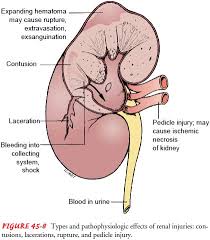 Image result for Genitourinary Trauma