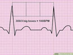 How To Read An Ekg An Interpretation Guide With Sample