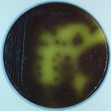 Innocua may cause difficulty or confusion in the laboratory identification of l. Oxford Agar