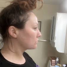 TOP 10 BEST Laser Hair Removal in Poinciana, FL