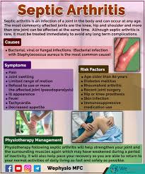 Image result for Septic Joint