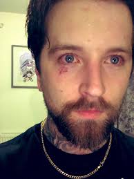 Daniel Winter-Bates 💙🧡