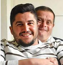 A loving father with Down Syndrome raised a son who grew up to become a  doctor 🥹