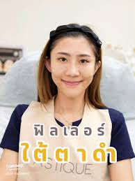 วิธีรักษาใต้ตาดำให้กลับมาขาวกระจ่าง