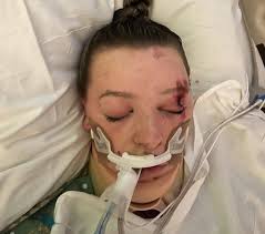 My Mom was just in the hospital due to a bad fall that resulted in a broken  hip. Not only that, she has been battling stage IV colon cancer that  metastasized to