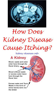 Pin On Kidney Disease Benefits Of