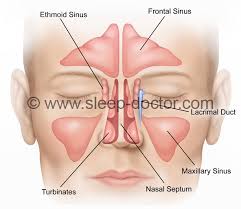 A sinus cyst looks like a small container that is filled with a liquid substance. Nasal Procedures Sleep Doctor