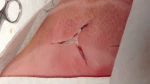 Image result for Corner Stitch