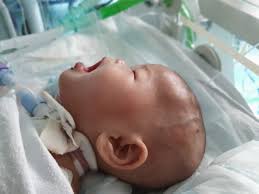 Live ainul mardhiah ahmad safiuddin tiba di klia. Ainul Mardhiah Stabil Tapi Masih Perlu Dipantau Codeblue