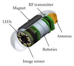 Image result for Wireless Capsule Endoscopy