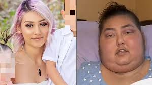 Man who lost both hands and one foot trying a basketball slam dunk says he  didn't feel any pain when it happen