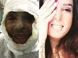 Gessica notaro ha rivelato via social che una persona per lei importante ha il coronavirus. Gessica Notaro La Miss Sfregiata Un Anno Dopo L Aggressione Con L Acido Corriere It