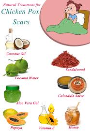 Pin On Home Remedies