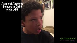 Image result for Absence Seizure