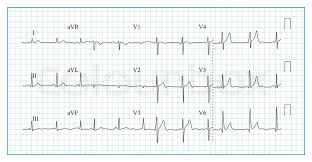 Heart Cardiogram Chart Vector Stock Vector Colourbox