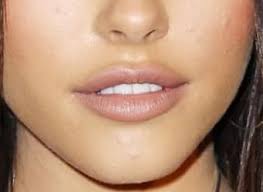 Sep 16, 2020 · three new hyaluronic acid fillers have entered the us market. Singer Madison Beer Shows Beautiful Youthful Lips Without Being Too Full What S The Secret Great Tooth Show Spiegel Jeffrey Drspiegel Com