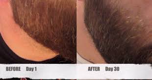 Shou wu, also knowns as foti or he shou wu, may be used for the following premature grey hair dry or brittle hair *he shou wu is generally considered safe for everyone, nevertheless, pregnant women are. Gray Hair Reversal Archives Lola S Life Lessons