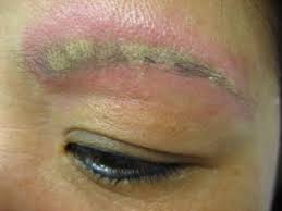 Tattoos for women half sleeve. When Cosmetic Tattooing Goes Wrong Emma Hall Beauty Permanent Makeup Birmingham